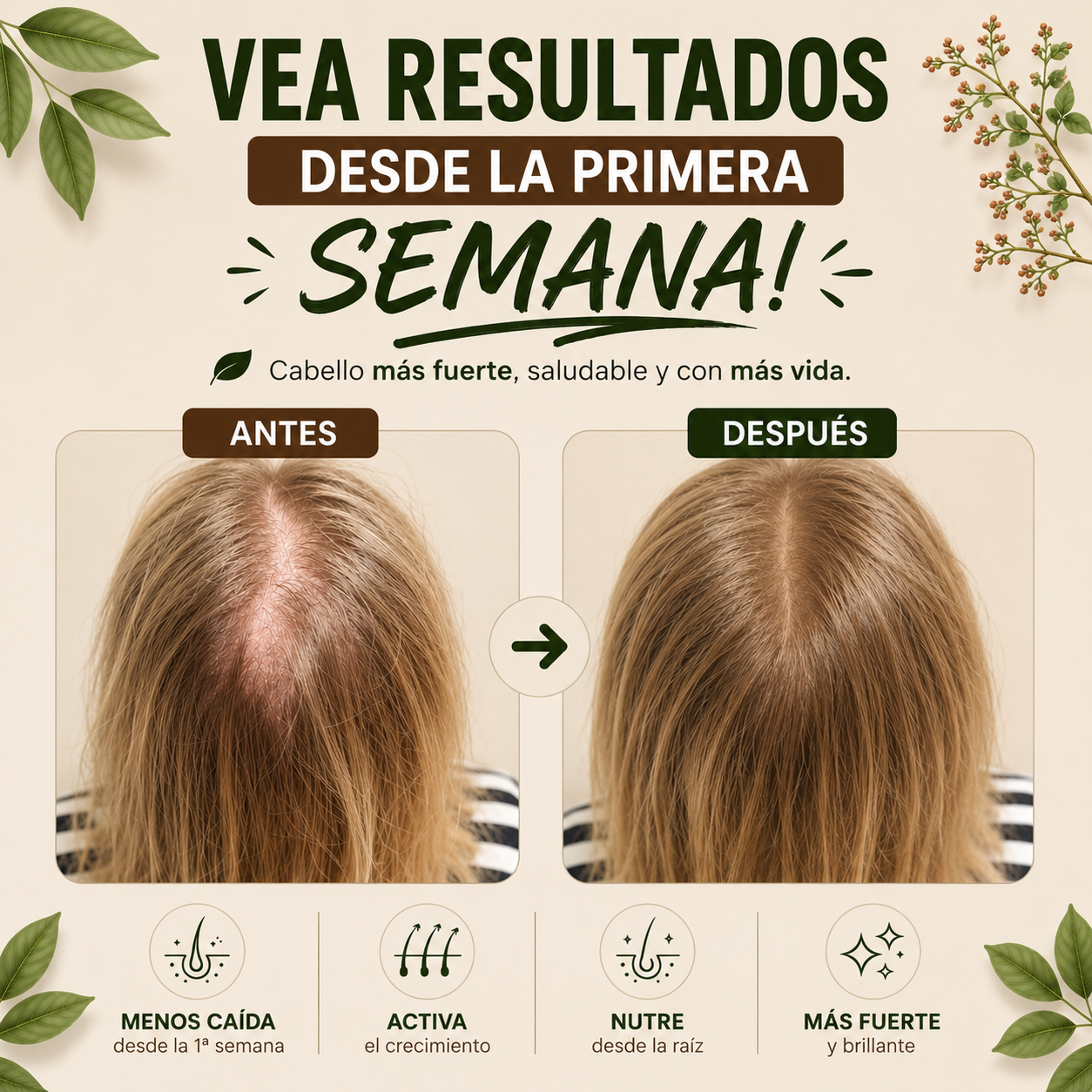 REVITA HAIR™ + ENVÍO GRATIS + PAGO AL RECIBIR + RESULTADOS EN 2 SEMANAS 🔥